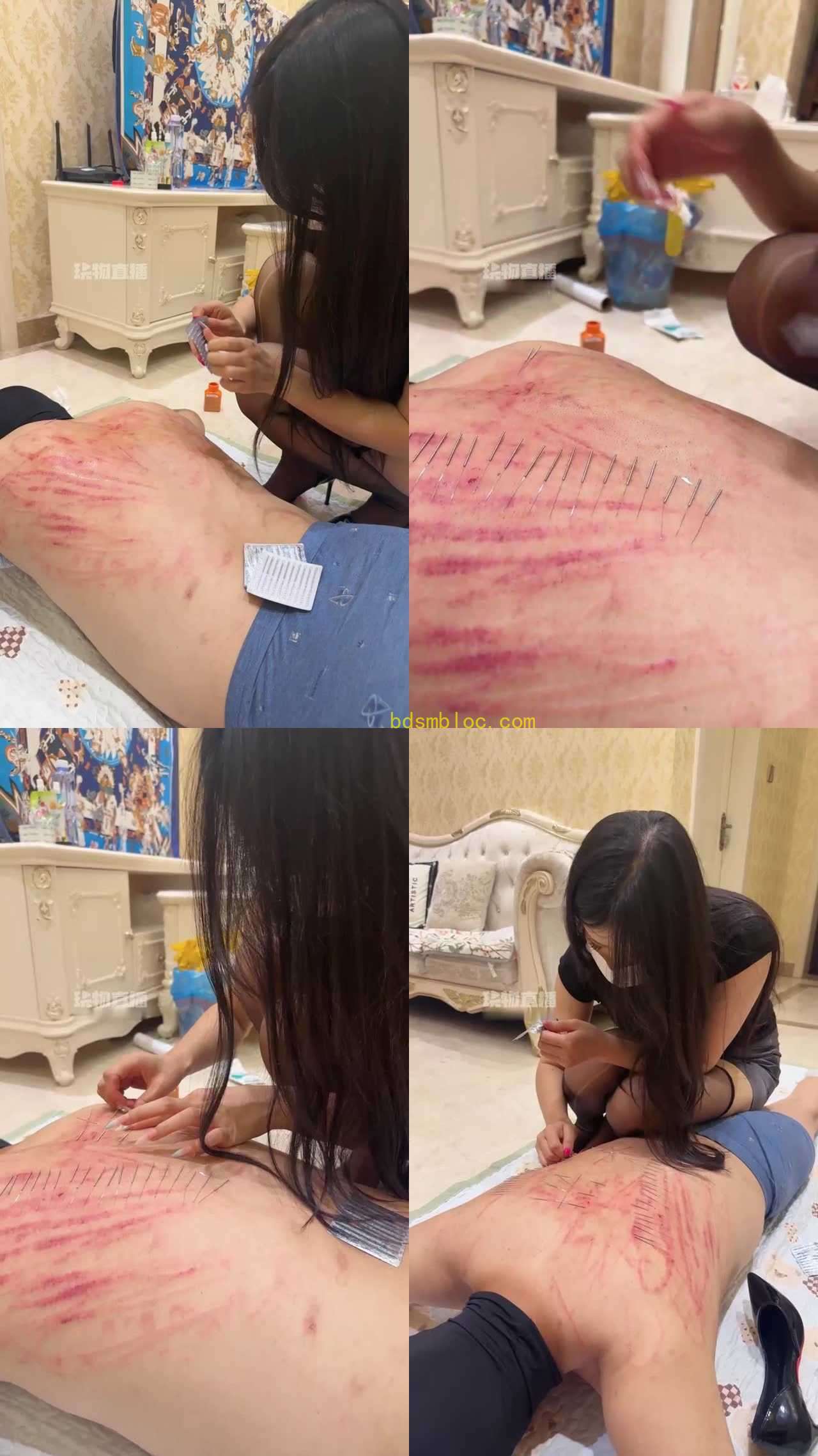 【玉米sss】穿刺花背口水消毒